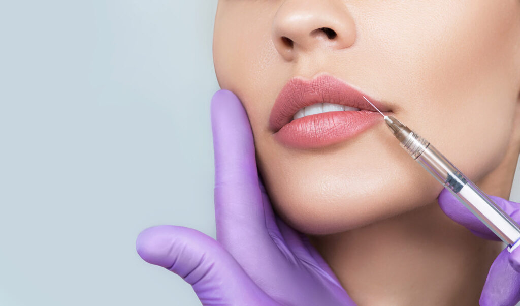 Cropped,Sensual,Female,Lips,,Procedure,Lip,Augmentation.,Syringe,Near,Womans